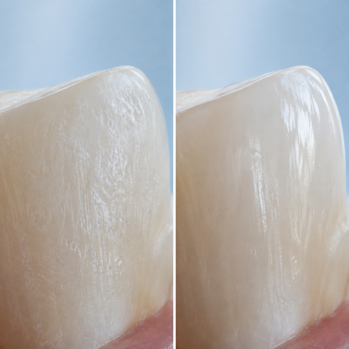 Conceptual comparison of rough and smoother-looking enamel surfaces