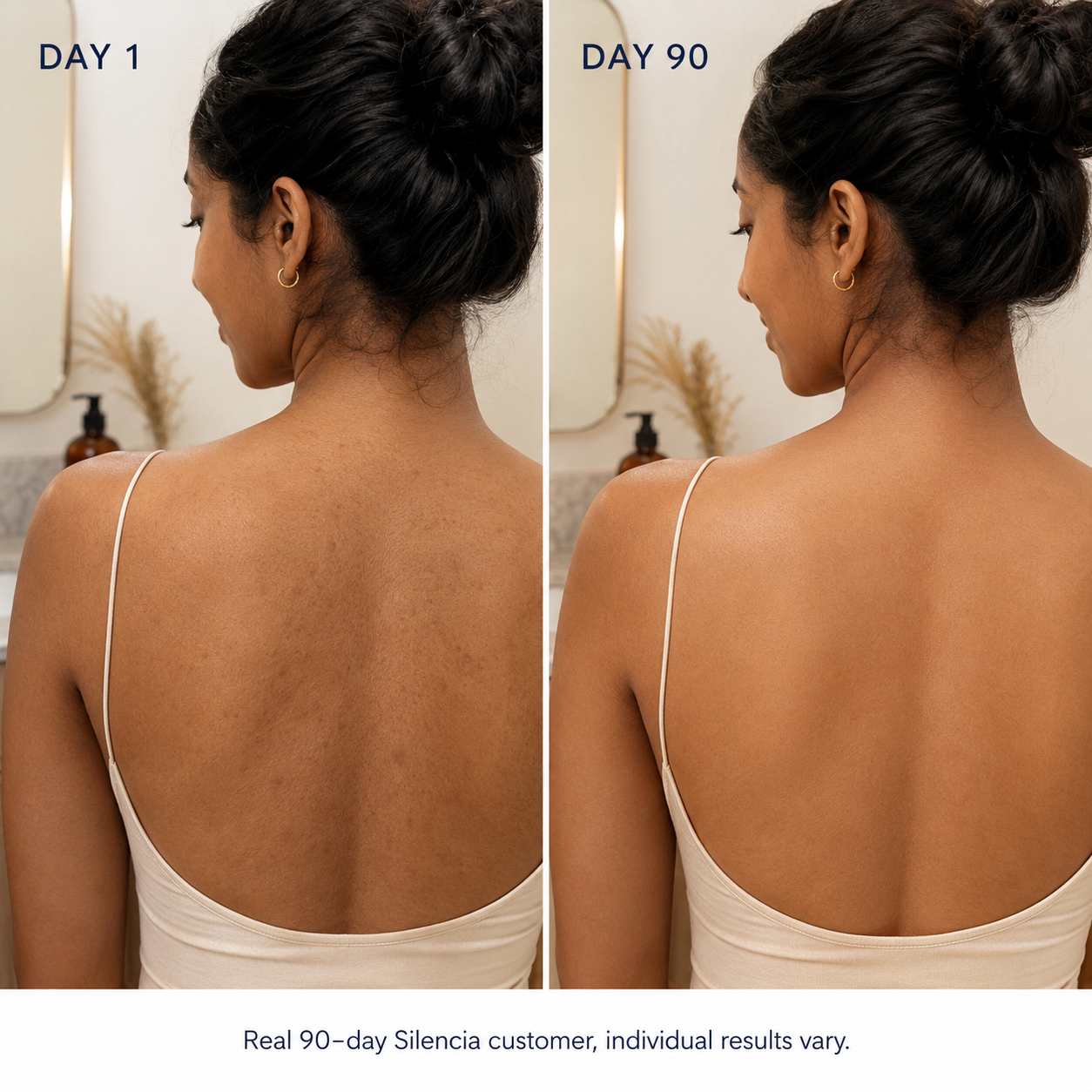 Real customer 90-day back transformation · individual results vary